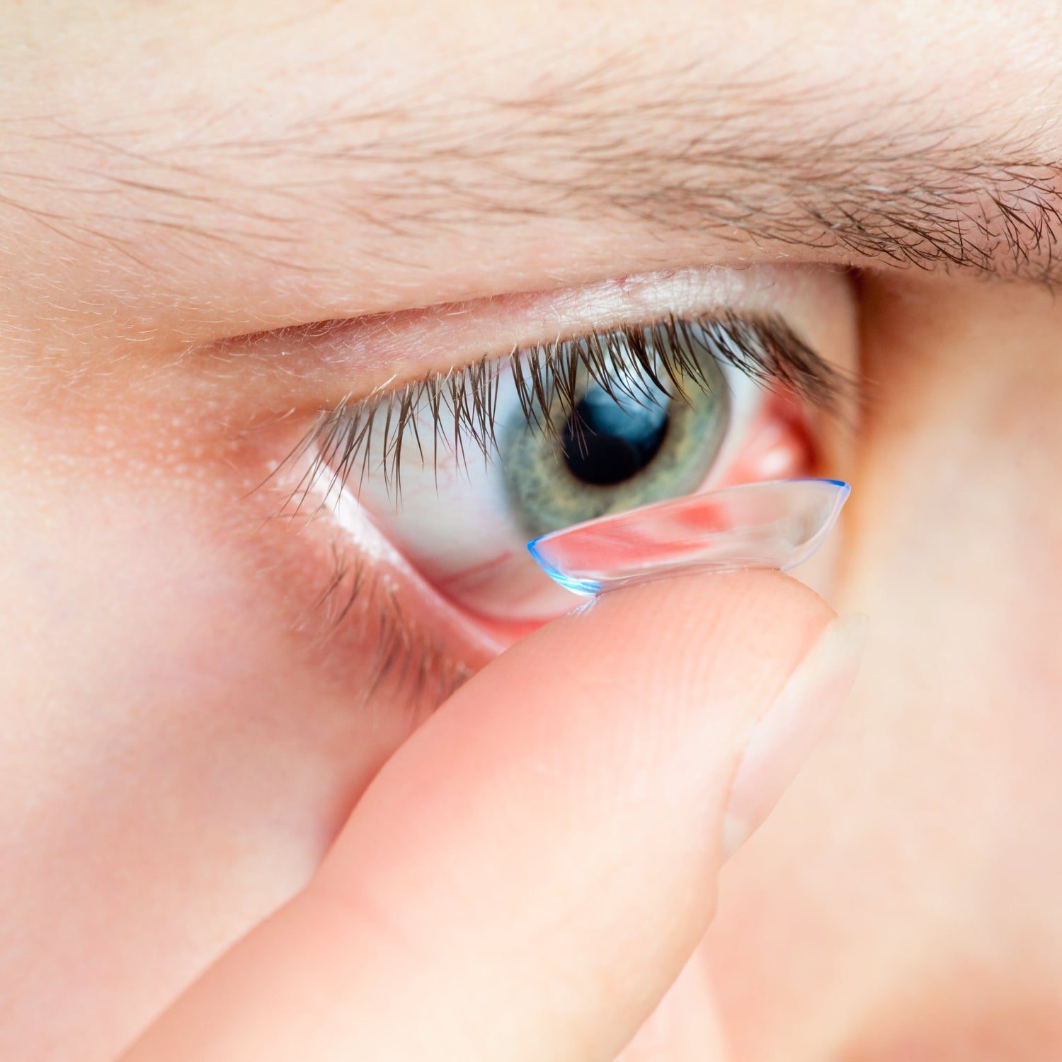 Contact Lenses